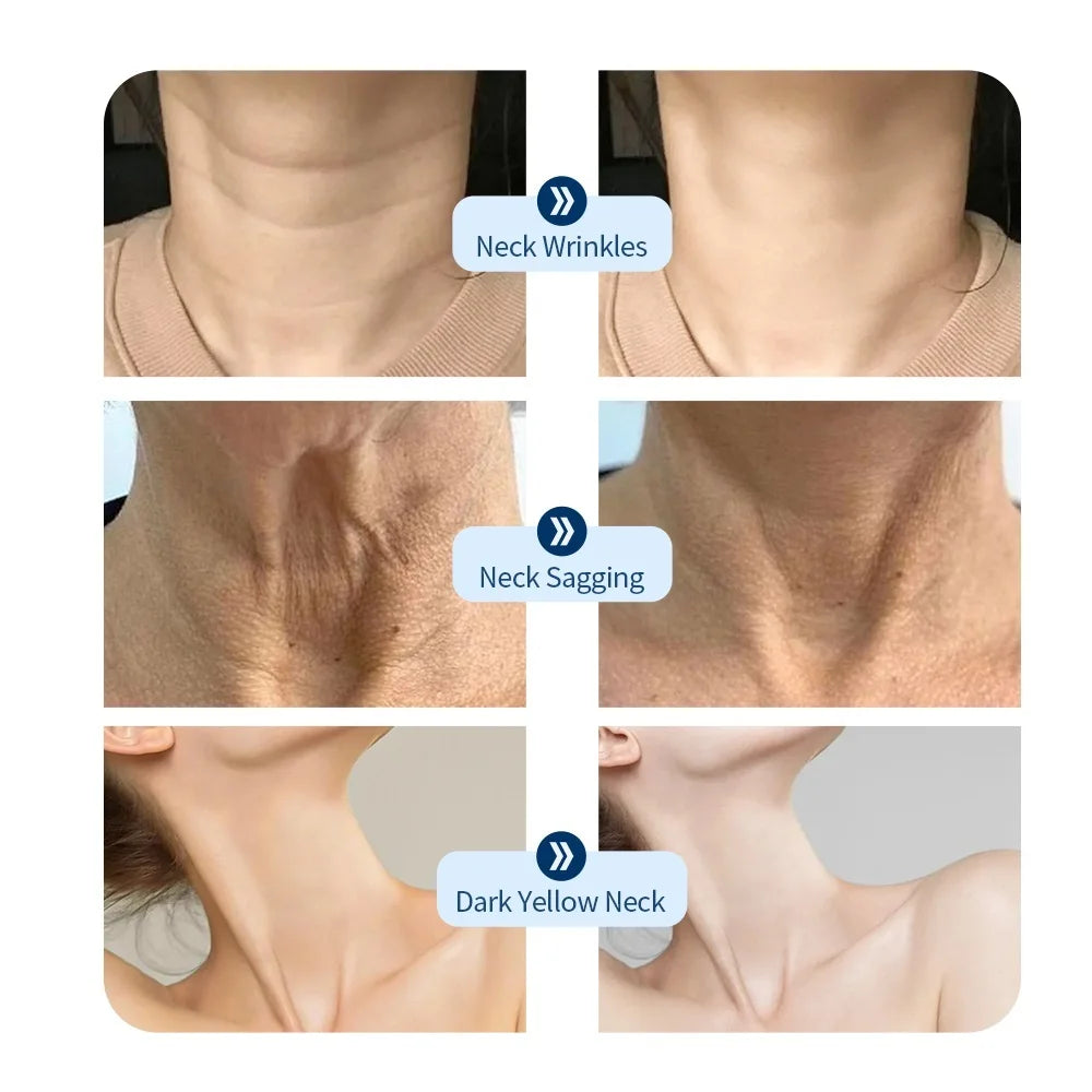 Neck LED Red Light Therapy Lift Mask Photon Anti-Wrinkle Skin Tightening Neck Beauty Device Skin Brighten Rejuvenation Wrinkle Remover